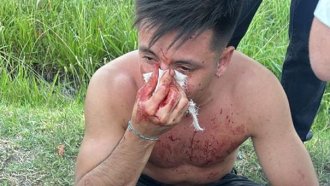  Un joven fue agredido por un grupo de rugbiers en Mendoza